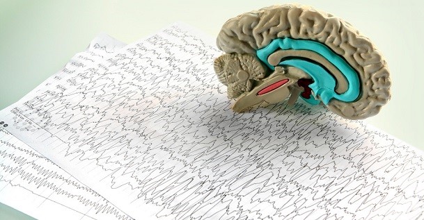 Methylation, MTHF and the brain and mind