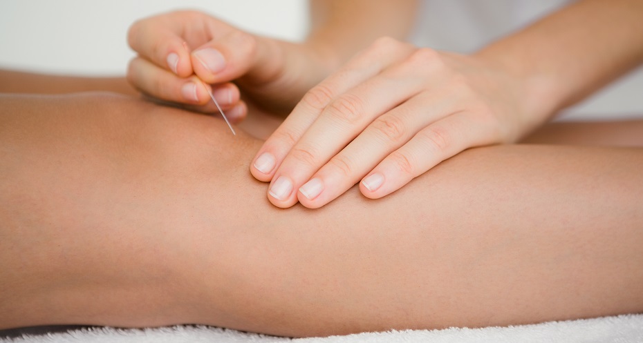 Acupuncture for pain knee pain in Halifax