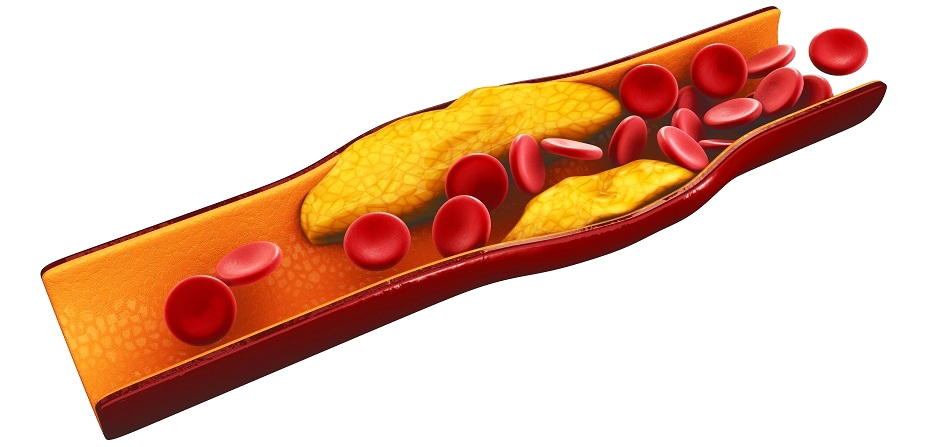 Smoking's affect on the cardiovascular system