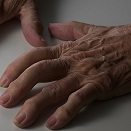 Arthritis: Medication & Natural Alternatives