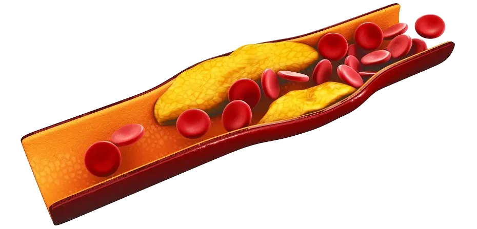 Smoking's effect on the cardiovascular system