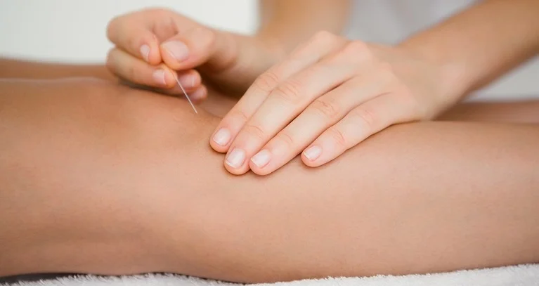 Acupuncture treatment