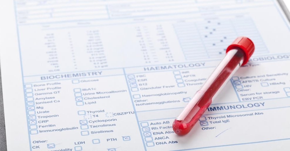 Laboratory Testing