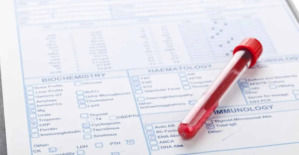 Laboratory blood testing and analysis