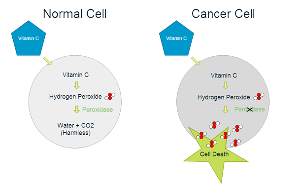 vitamin-c-cancer-hydrogen-peroxide