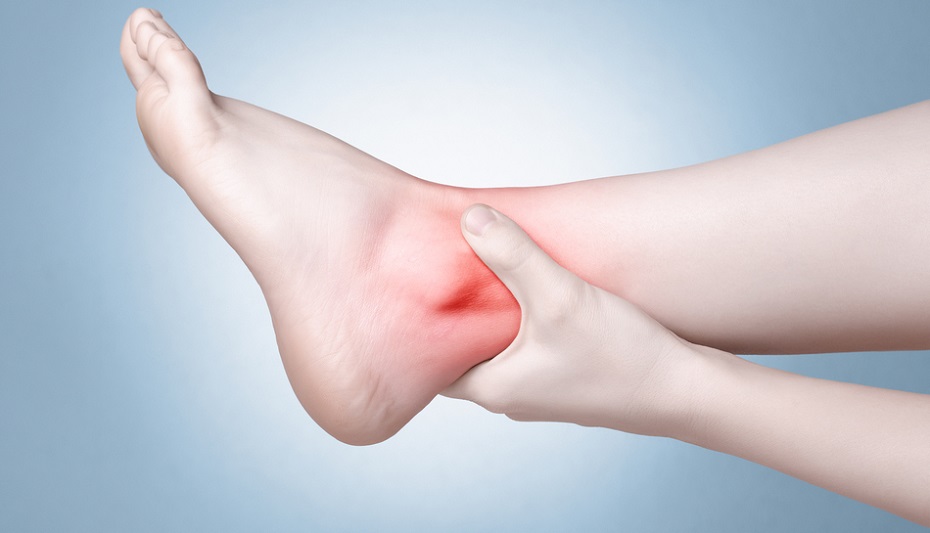 Achilles tendinitis