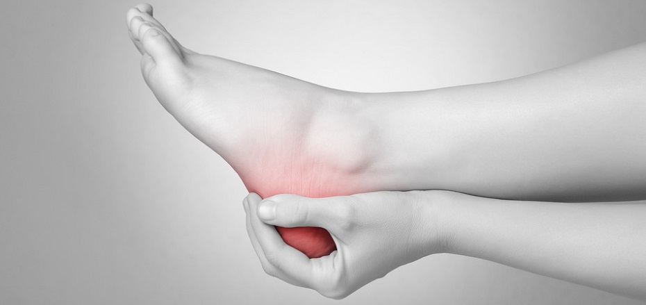 plantar fasciitis