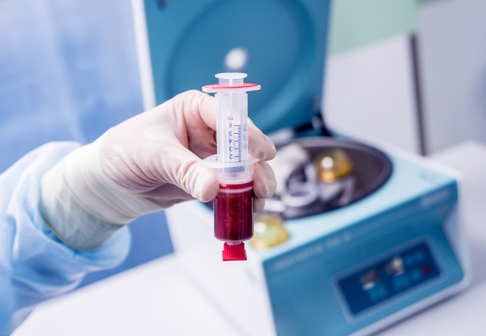 Platelet-rich plasma preparation