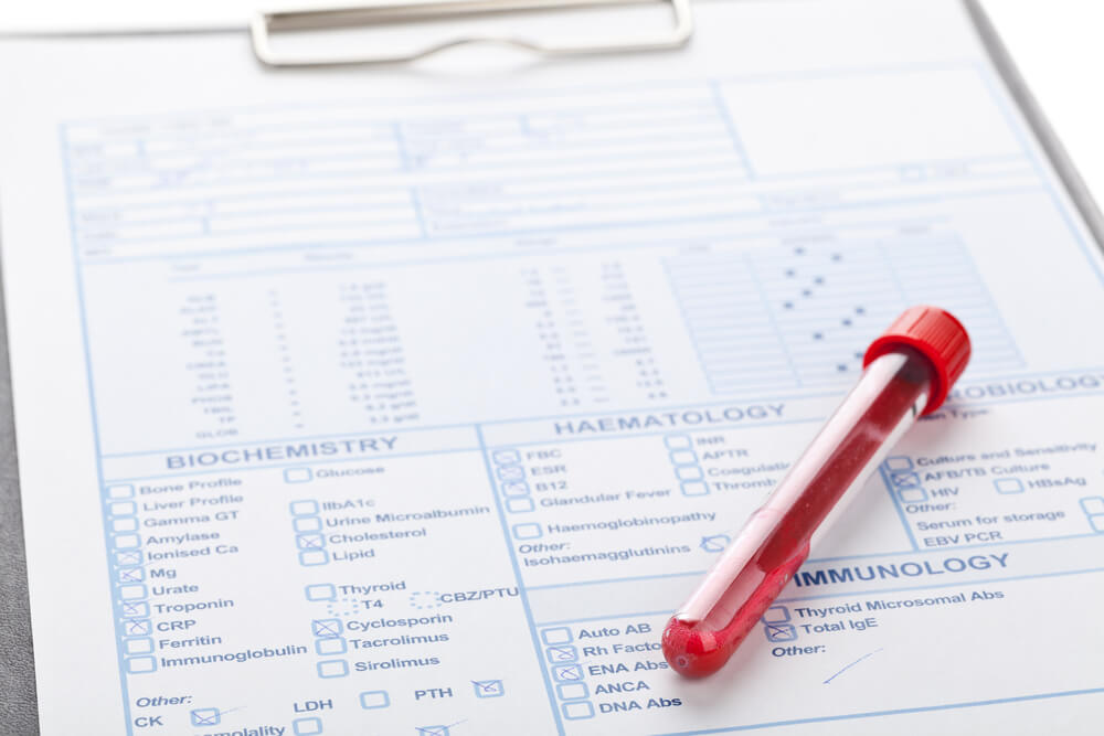 Blood test results