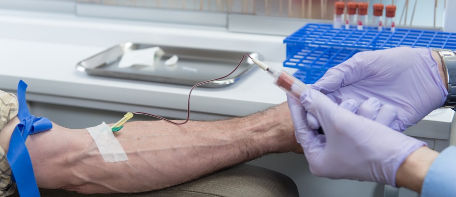 Platelet-rich plasma treatment